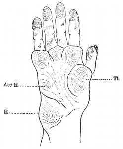 "All these signs are peculiar to what is called in neuropathology the monkey hand."